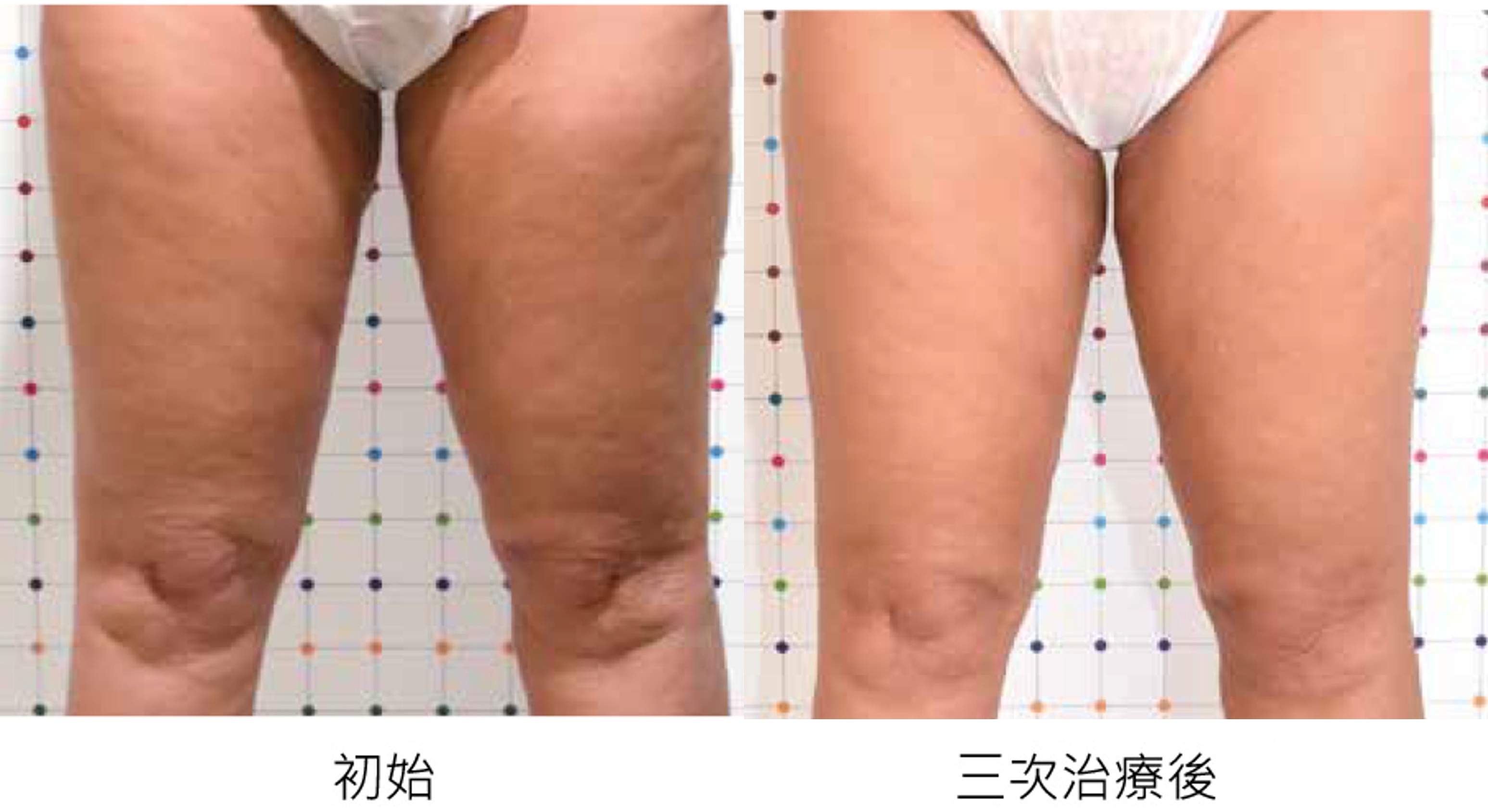before_after