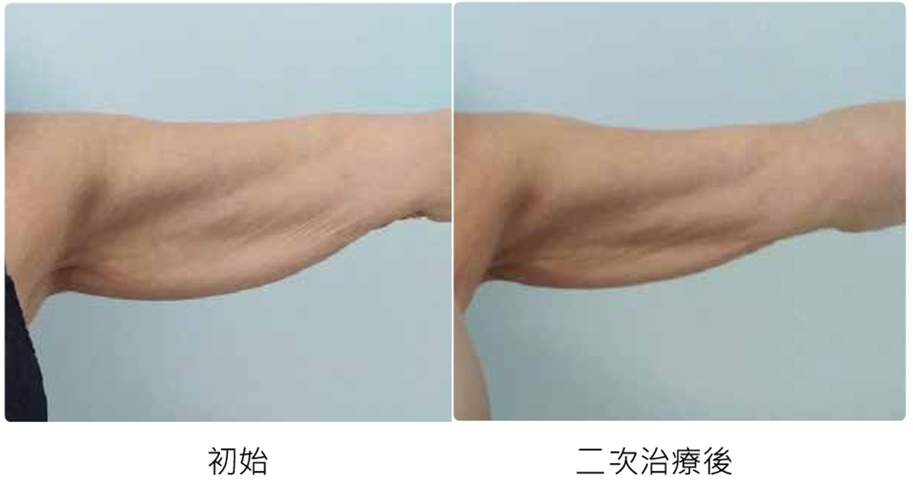 before_after