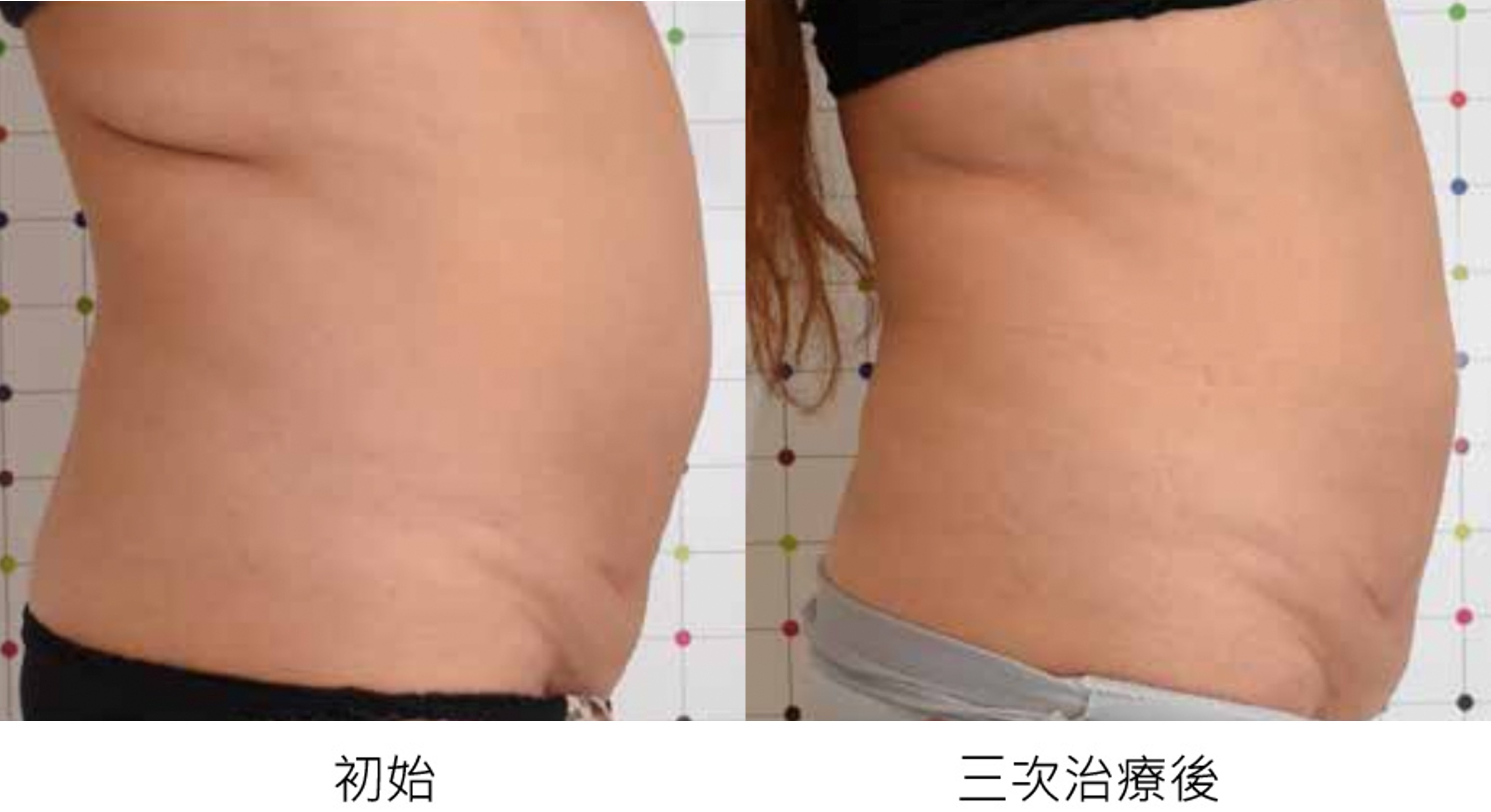 before_after